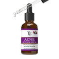 YC ACNE SERUM 30ML